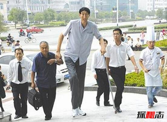盘点十大世界上最高的人,清代巨人詹世钗高3.19米是假