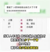 24岁女孩儿入职体检 发现只有一个肾脏（身体缺陷）