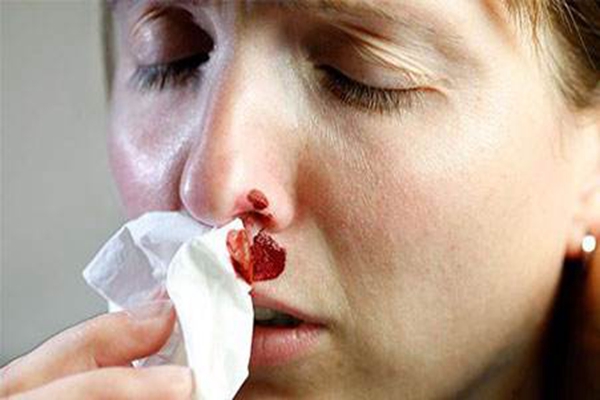 为什么鼻子总爱出血?鼻部或全身疾病所致(