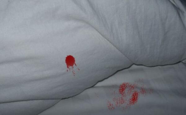 床单上的落红图片