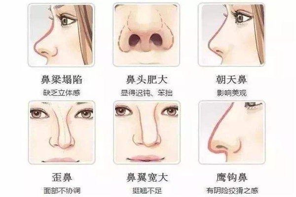 鼻子类型有福气图片