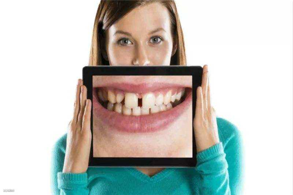 世界上牙齿最大的人图片