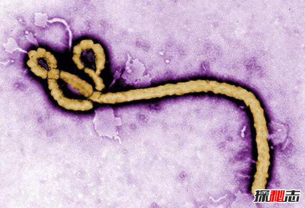 埃博拉病毒吐内脏糜烂图片